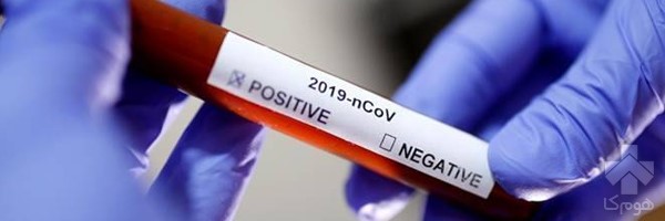 آزمایش کرونا
