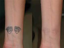 مضرات و عواقب خالکوبی