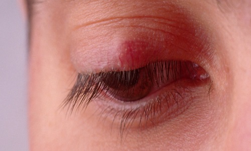 چرا در فصل بهار گل مژه میزنیم؟! چرا در فصل بهار گل مژه میزنیم؟!