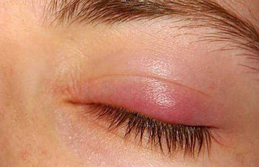 چرا در فصل بهار گل مژه میزنیم؟! چرا در فصل بهار گل مژه میزنیم؟!