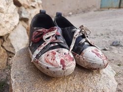 واکنش کاربران شبکه اجتماعی به انفجار و شهادت کودکان افغانستانی