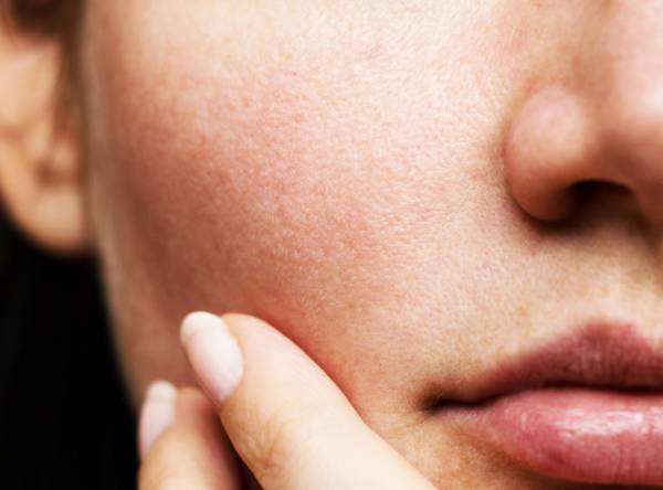 منافذ پوستی