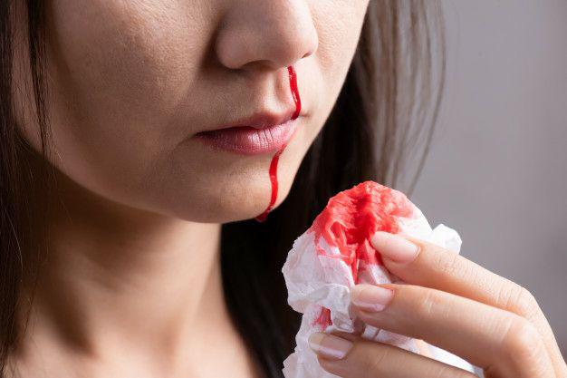 چرا خون دماغ می شویم؟