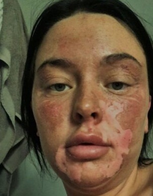 دختر انگلیسی