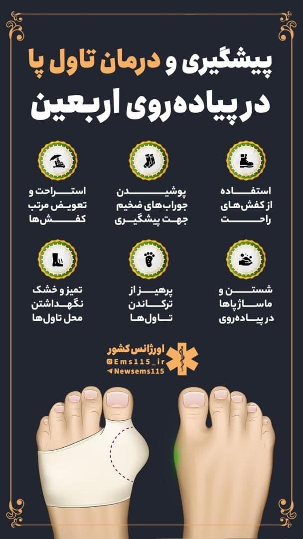 اینفوگرافیک تاول