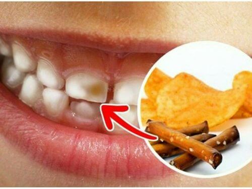 آسیب چیپس به دندان