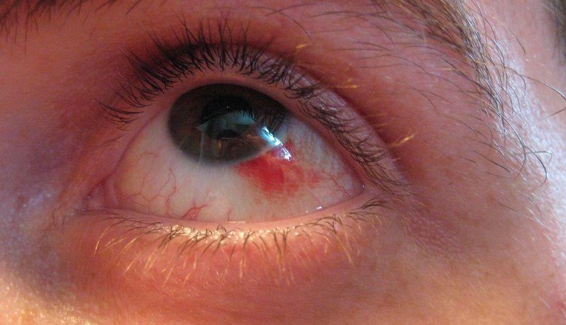 راز‌هایی که چشمهایتان درباره شما برملا می‌کنند!