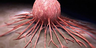 مهمترین علت سرطان پستان