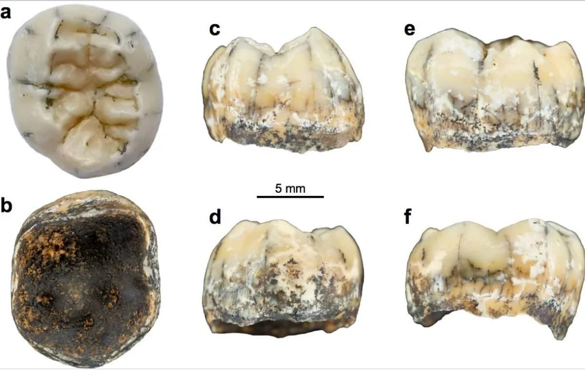 دندان یک انسان باستانی