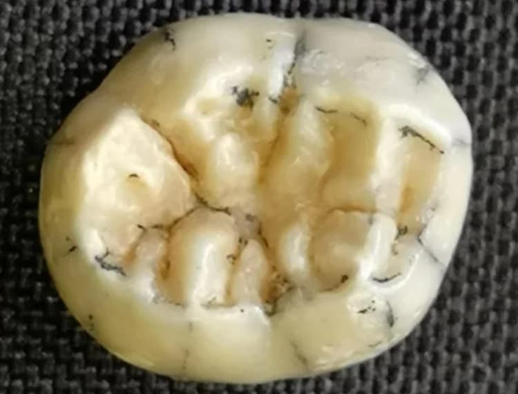 معمای کشف دندان یک دختربچه ۱۶۰ هزار ساله