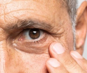 خطراتی که چشم ها را تهدید می کند!+توصیه هایی برای تابستان