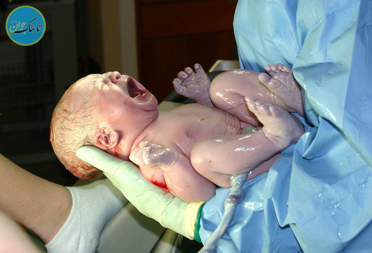 چرا سزارین خطرناک است