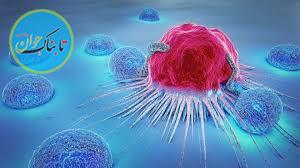 شایع ترین نوع سرطان در مردان!