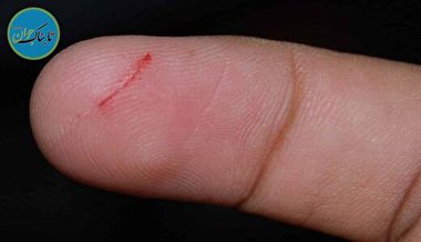 چرا بریدن پوست با کاغذ اینقدر دردناک است؟