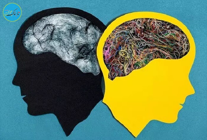 مغز اسکیزوفرنی