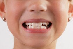 راهنمای رویش صحیح دندان دائمی چیست؟