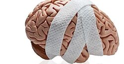 ارتباط ضربه مغزی و کاهش ضریب هوشی کودک