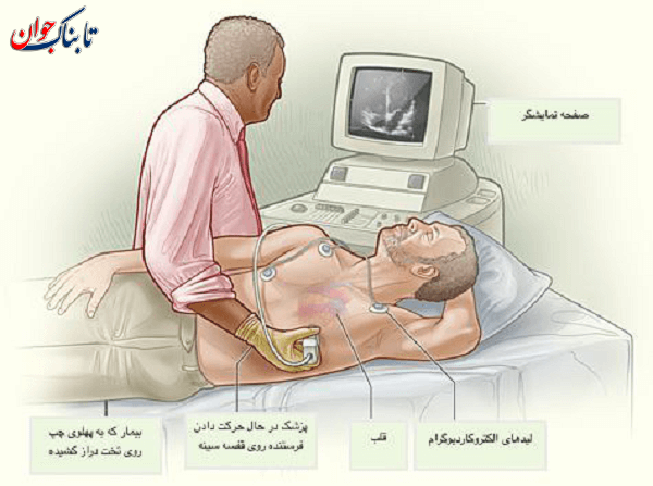 تصویر اکو قلب اکو قلب چگونه است و چقدر طول میکشد؟