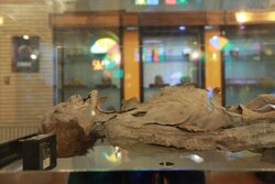 جمجمه جراحی شده و زن مومیایی در موزه تاریخ علوم پزشکی