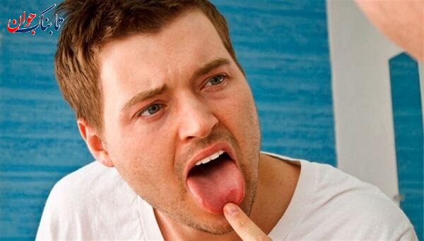 علت تلخی دهان چیست؟