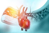 افزایش احتمال فیبریلاسیون دهلیزی در زنان یائسه با استرس 