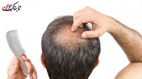 تغذیه چه نقشی در سلامت پوست و مو دارد؟
