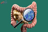 آیا پارکینسون از روده شروع می شود؟