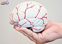 احتمال سکته مغزی با آسیب خفیف سر