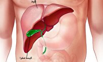 چگونه کبدی سالم داشته باشیم؟